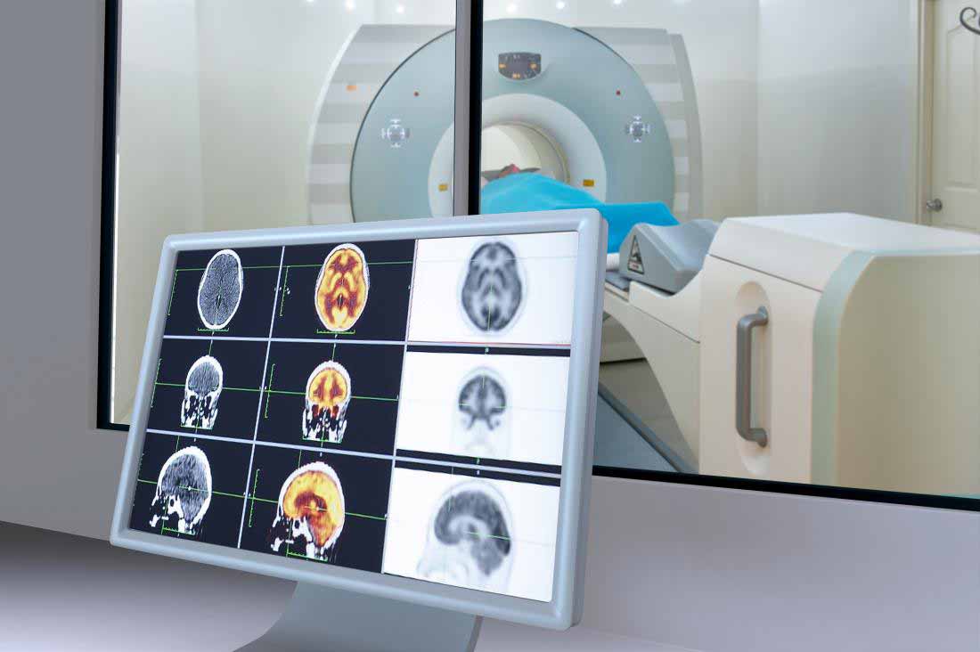 اسکن MRI از مغز